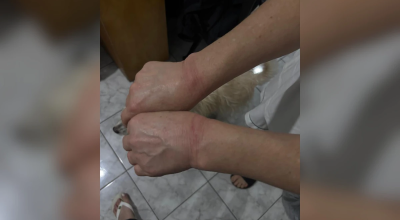 1 de 1 Imagem colorida de marcas de lesão em punhos. Metrópoles - Foto: Divulgação/ Polícia ...