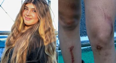 Sofia, filha de Grazi Massafera e Cauã Reymond, posa com machucados no Lollapalooza  • Marcel...